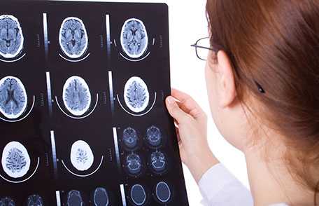 Female doctor examining a brain cat scan