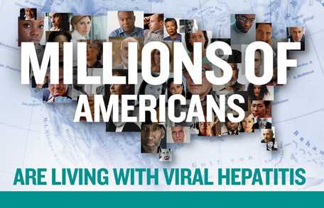 Millions of Americans are living with viral heptatitis