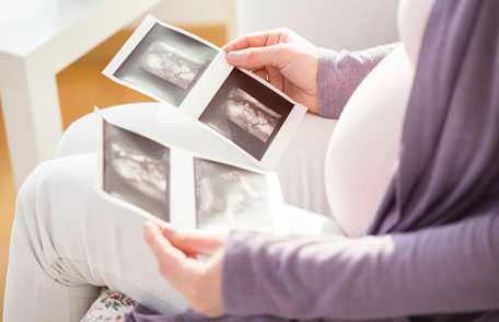 Woman looking at photos of sonogram