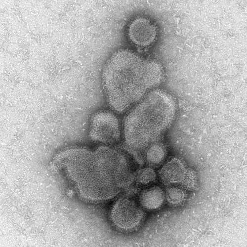 Electron Micrograph Images of H7N9 Virus from China