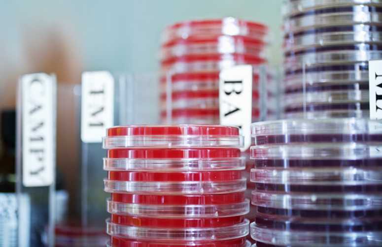 Stack of Petri Dishes