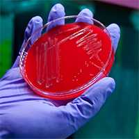 	Image showing final stage of the bacterial culture process in red culture dish