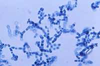 	Arthroconidia of Coccidioides immitis