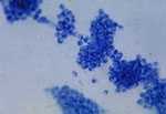 Photomicrograph of the fungus Candida albicans