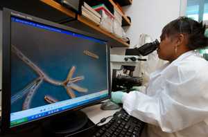 CDC scientist Carol Bolden examines microscopic slides showing Exserohilum rostratum (on screen) during the multistate meningitis outbreak.