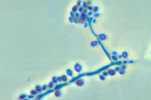 	Photomicrograph showing Sporothrix schenckii.