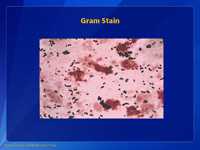 Gram Stain