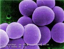 Staphylococcus aureus