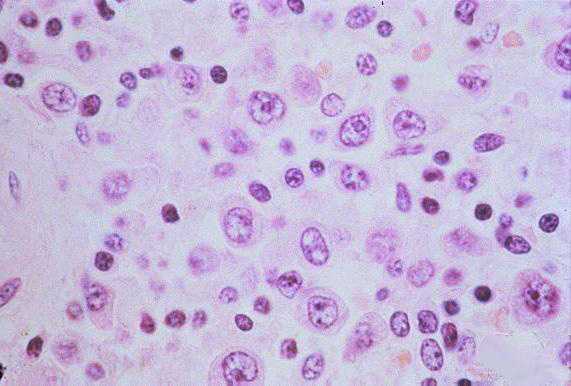 immunoplasts in the periarteriolar sheath of the spleen