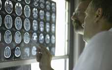 Doctors looking at brain scans