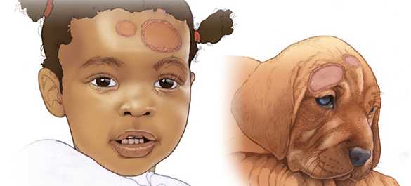 Medical illustration of how ring worm might appear on a child and a pet