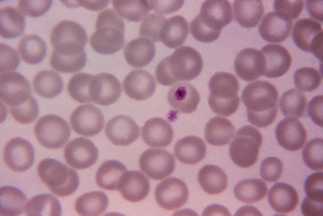 microscopic examination using Giemsa stain