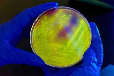 Yellow-green fluorescence of Clostridium difficile under long-wave UV irradiation on a CCFA plate. Photo: James Gathany