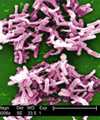 Clostridium difficile.