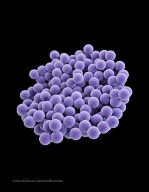 Medical illustration of methicillin-resistant Staphylococcus aureus (MRSA).