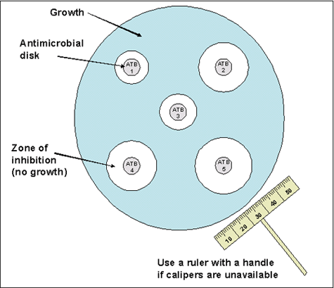 Figure 1 is a picture showing the antimicrobial susceptibility disk diffusion test: approximate disk placement and measurement of inhibition zone diameters. ATB1 = antibiotic 1, ATB2 = antibiotic 2, etc.