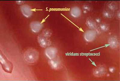 Figure 15 is a picture showing that S. pneumoniae colonies have a flattened and depressed center after 24-48 hours of growth on a blood agar plate (BAP), whereas the viridans streptococci retain a raised center.