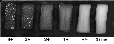 Figure 6 is a picture showing the rating the intensity of the agglutination reaction.