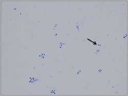 Figure 7 is a picture showing that in a positive quellung reaction, the capsule appears as an enlarged clear halo surrounding the dark blue stained cell.