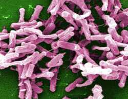 Gram-positive C. difficile bacteria from a stool sample culture obtained using a .1µm filter