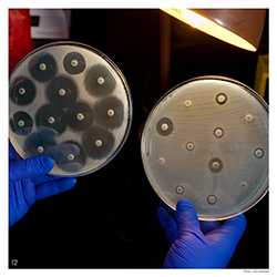 Scientist holding lab samples