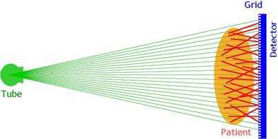 Figure 5a. Cone-beam radiography.