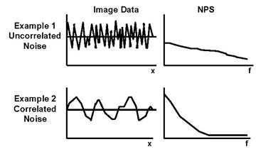 Figure 3, Schematic of the NPS (one-dimensionally) representing the noise attributes of a digital radiographic system. 