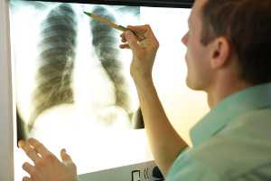 	Person looking at a lung x-ray