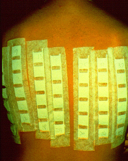 	SLIDE 100 - Patch test