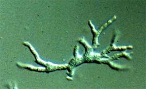 Trophozoites of B. mandrillaris in culture. 