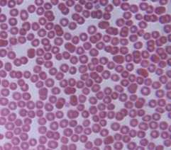 Microscopic red blood cells