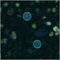 Cyclospora oocysts