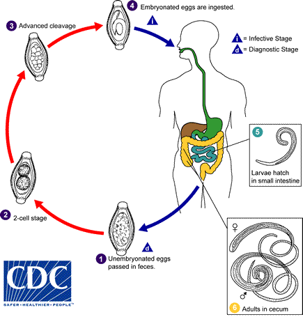 Trichuris trichiura lifecycle