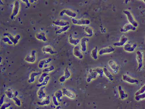 A wet mount of Naegleria fowleri trophozoites cultured from the CSF of a patient with primary amebic meningoencephalitis (PAM) viewed using phase contrast microscopy. Magnification: 600x.