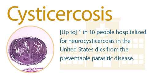 cysticercosis