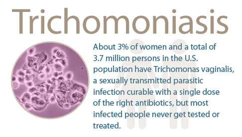 Trichomoniasis