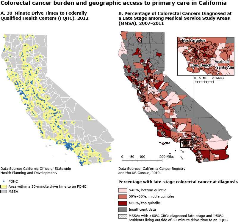 	Colorectal cancer burden and access to primary health care, California. A vast majority of Californians (96%) live within a 30-minute drive of a federally qualified health center (FQHC). This is true for areas in both the top and bottom quintiles (96% and 93% respectively) based on the percentage of colorectal cancers (CRC) diagnosed at a late stage. There was no meaningful connection found between geographic access to affordable CRC screening services and late-stage diagnosis percentages. This finding suggests that other barriers besides physical distance to affordable CRC screening need to be examined in order to reduce the geographic disparities in late-stage CRC diagnoses.