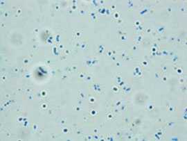 Pneumococcal strain reacting with type-specific antiserum (Quellung reaction) prepared in CDC’s Streptococcus Lab.