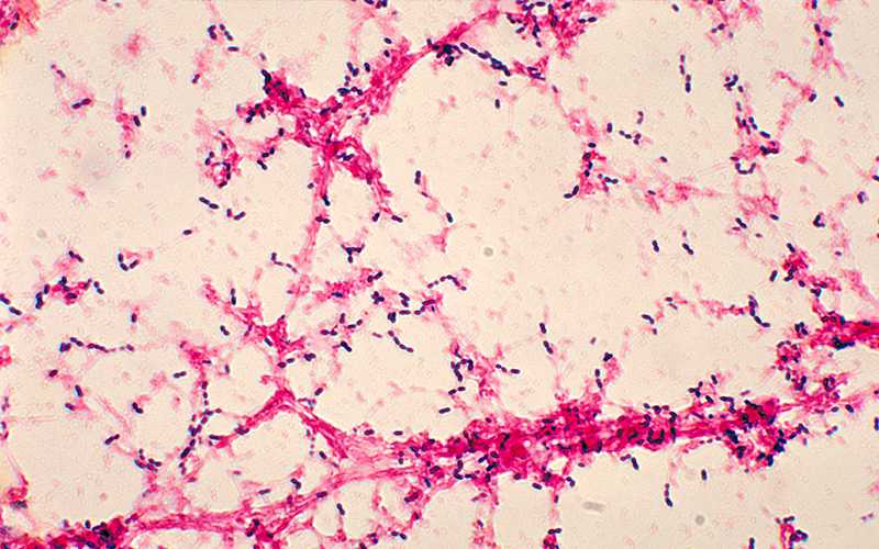 Photomicrograph of Streptococcus pneumoniae bacteria having been grown from a blood culture