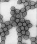 Transmission electron micrograph of rotavirus.