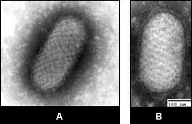 Figure 5EM of parapoxvirus (Orf virus) from tissue culture (5-A) and clinical specimen (5-B). 