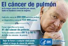 El cáncer de pulmón es la mayor causa de muertes por cáncer, tanto en hombres como en mujeres. Cada año, cerca de 200,000 personas reciben un diagnóstico y cerca de 150,000 mueren. Fumar cigarrillos es la causa número 1 del cáncer de pulmón. Se ha vinculado a entre el 80 y 90 porciento de todos los cánceres de pulmón. Dejar de fumar a cualquier edad puede reducir el risgo de cáncer de pulmón.