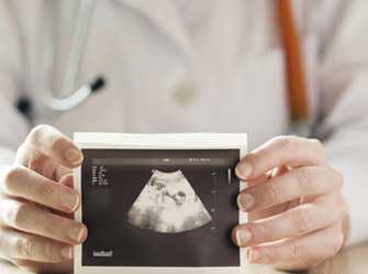 Un médico sosteniendo una foto de una ecografía