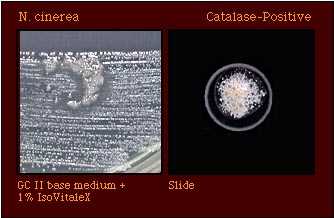 catalase