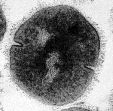 Streptococcus pyogenes