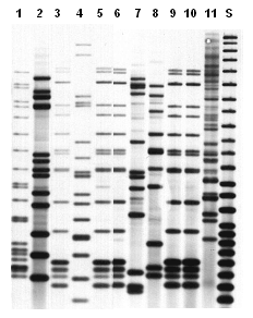 Image: Representative IS6110-based RFLP image. Isolates represented by lanes 3, 5, 6, 9, and 10 have the same pattern and were epidemiologically linked. Lane S shows the CDC molecular weight standard.