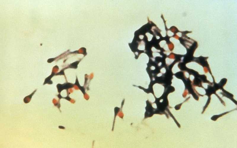 Haemophilus influenzae using immunofluorescence