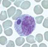 image of ehrlichiosis bloodsmear