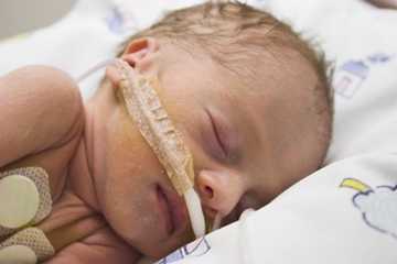 Preterm baby in an incubator