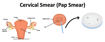 Pap test